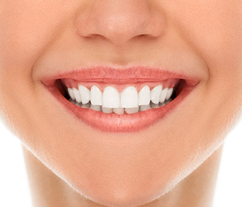 Diş Beyazlatma Tedavisi Nasıl ve Hangi Aralıklarla Yapılır?