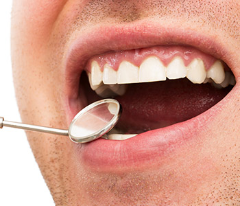 Diş Eti Hastalıklarının Nedenleri, Belirtileri ve Tedavisi